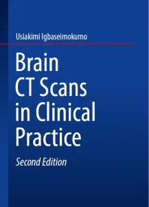 دانلود کتاب Brain CT Scans