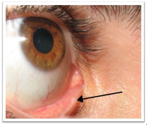 پرستاری داخلی و جراحی چشم